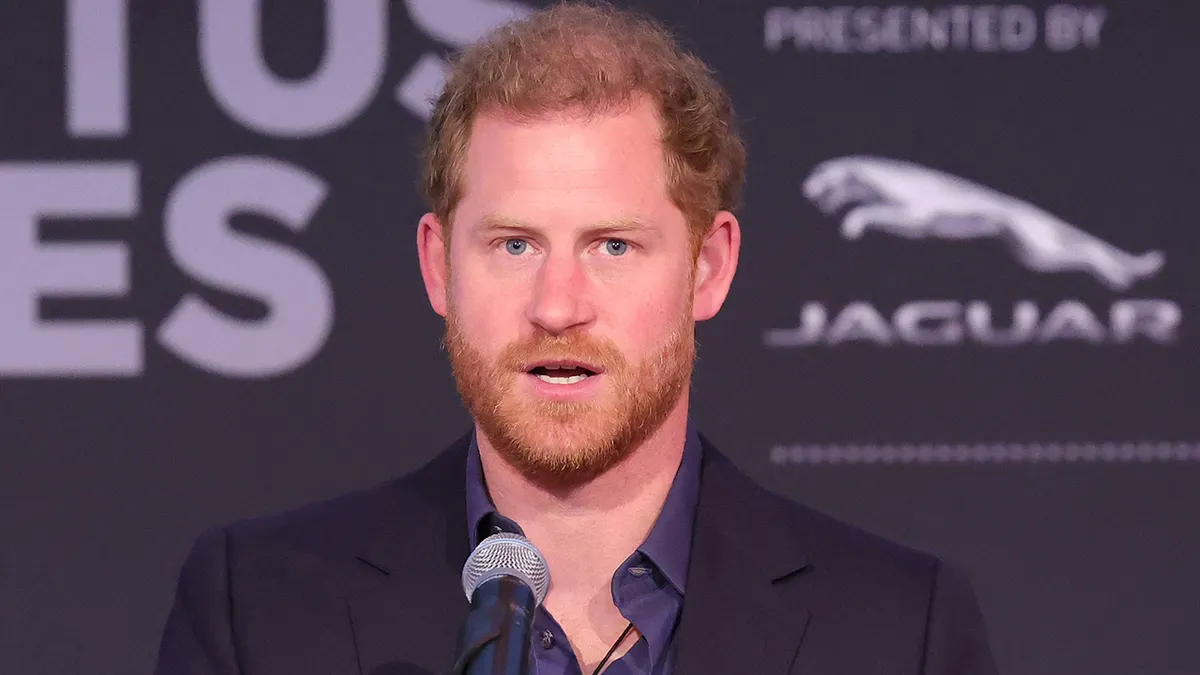 Prince harry bald news