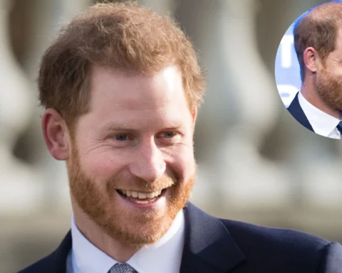 prince harry bald